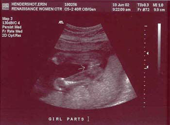 6-19-02ultrasound1