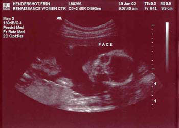 6-19-02ultrasound2